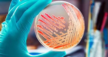 Microbiology